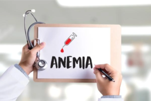 anemia 300x200 - 8 Causas da Queda de Cabelo